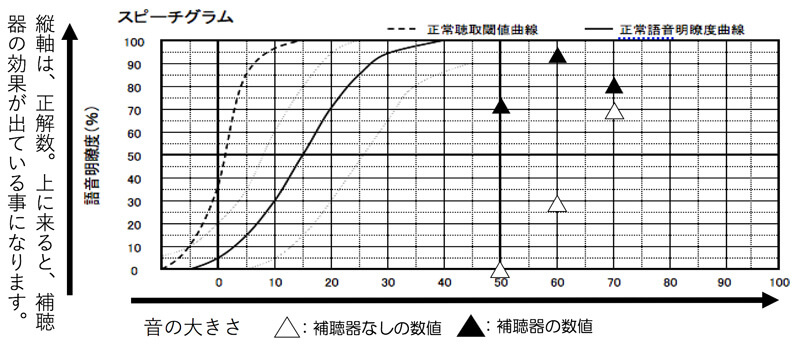 元々の音声の理解度が少し低く、音は聞こえるが、言葉がわかりづらい。という耳の状況。補聴器を装用すると、聞こえの改善度は、非常に上がるが、改善値は、少しまばらになる事が多い。