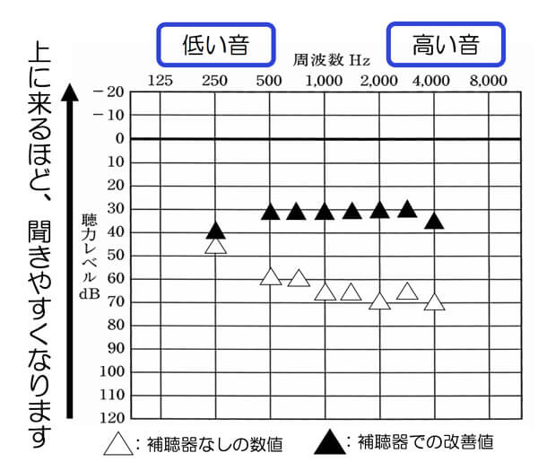 まるで聴力検査のように補聴器を使用した状態を調べることができます。補聴器あり、なしで調べることができ、それぞれの音の高さ別にどのように補えているのかを調べられます。