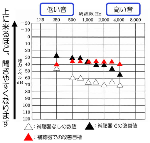 私の聴力の場合は、高い音が下がり、それにより、聞きにくくなっていたり、言葉がはっきりしづらい状況ですので、その部分をしっかり補ってあげることが、改善する上では、重要になってきます。高い音が聞こえないからそうなっているのに、実際にしていることは、真逆だったわけですね。