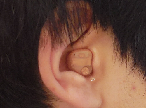 ベントは、特に耳あな形補聴器やイヤモールドといった耳の形を採取して作る製品によく用いられます。