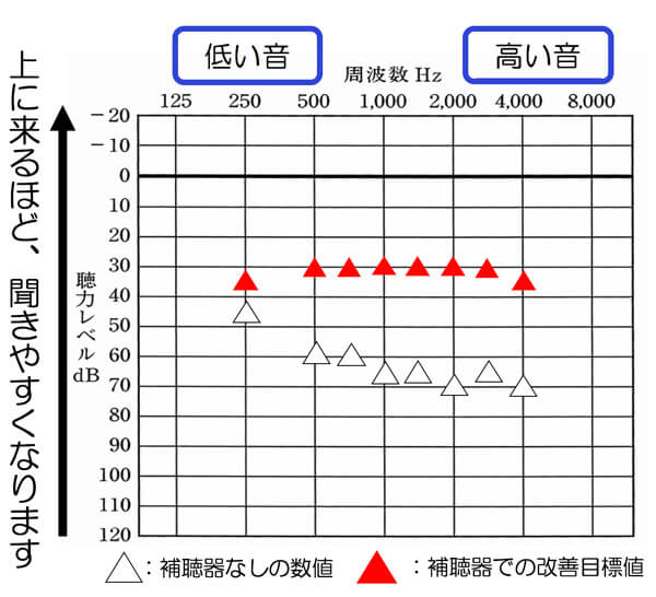 あくまでも私自身が感じている感覚ですが、全体的に30dB付近まで改善できると、40 dBの小さい入力音の部分も改善しやすくなる傾向を感じます。50dBまででいいのであれば、35dBまで、改善できると、改善しやすくなります。
