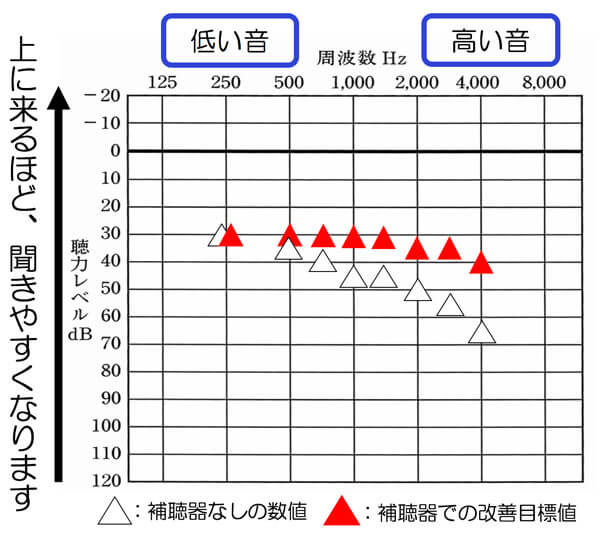 高音漸傾型の聞こえの場合、おおよそ改善できるといい数値は、このくらいになります。
