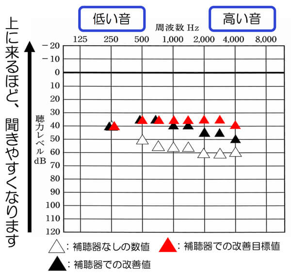 このように補聴器を使用した状態を調べながら、改善していくと、自分の聞こえを理解しながら、改善することができます。そのようにして、なるべく改善できると良い部分まで、改善していきましょう。ただし、無理だけは、しないようにしてください。