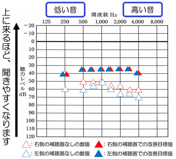 左右とも聴力が異なる場合は、左右別々でみながら、改善していけると、聞きにくさは、改善しやすくなります。