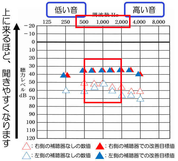 両耳ともこのあたりの改善については、目標値まで、改善できると、聞きにくさを改善しやすくなる傾向があります。