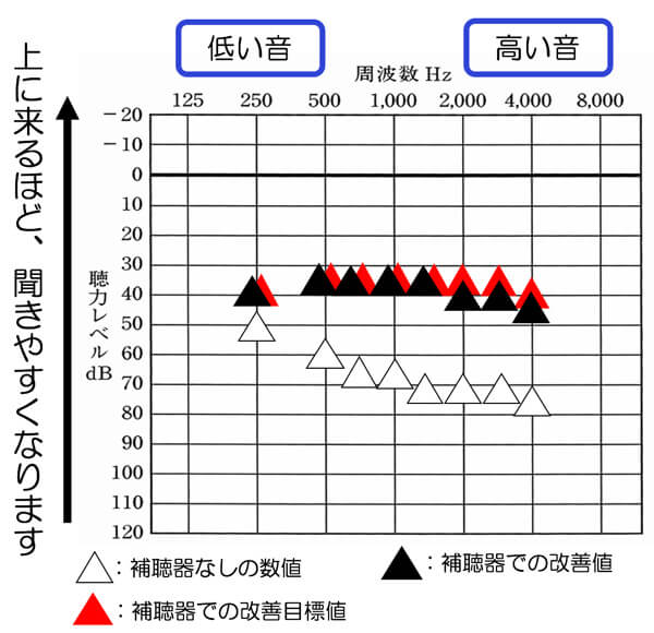 補聴器のご相談をしつつ、少しずつ、改善目標値まで改善していきます。無理に行わず、使える範囲内から初め、音を大きくしても良さそうになってきたら、徐々に改善度を上げていきます。