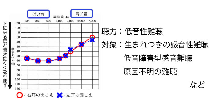 低音性難聴に合う補聴器と聞こえを改善させる4つのポイント パートナーズ補聴器