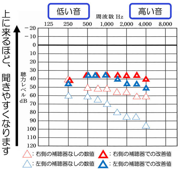聴力差が元々大きい場合は、補いきれないことが多いため、補える部分は、補い、難しい部分は、別々に考え、それぞれの改善目標まで、改善できるといいですね。