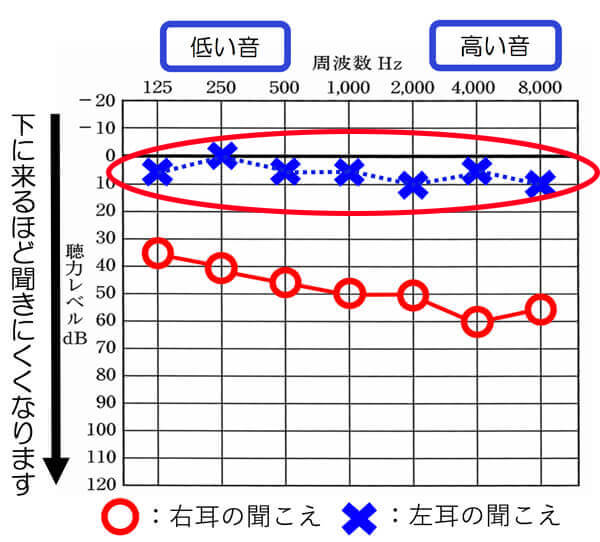 補聴器を装用した状態を調べる場合、大抵のケースで、聞こえの良い方が反応してしまいます。そのため、聞こえの良い方は、なるべく阻害するようにして、聞こえない耳側の効果を知る必要があります。