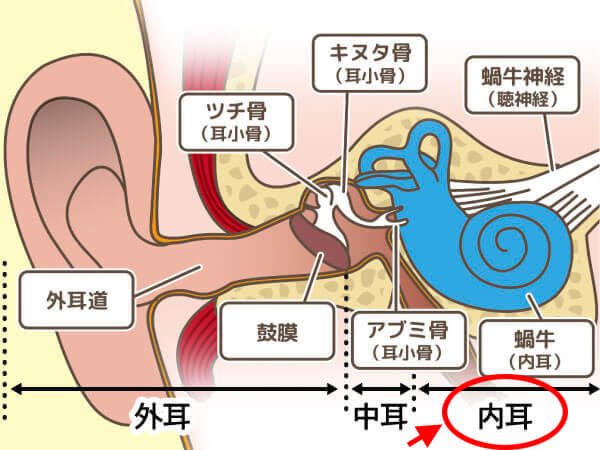 騒音性難聴は、耳の中にある内耳（ないじ）にダメージがいき、聞きにくくなる難聴です。