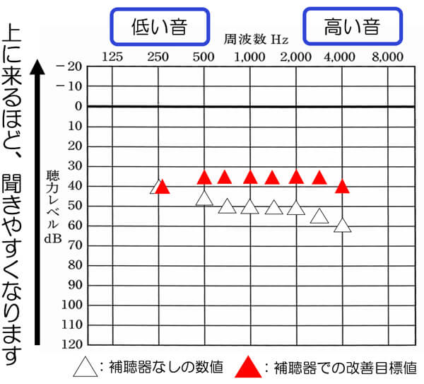 補聴器には、概ね、改善できると良い数値。というのがあります。その部分を把握することが、大切です。なぜなら、補聴器を装用しても、聞こえがどのくらい改善できているのかを自分で理解するのは、非常に難しいためです。