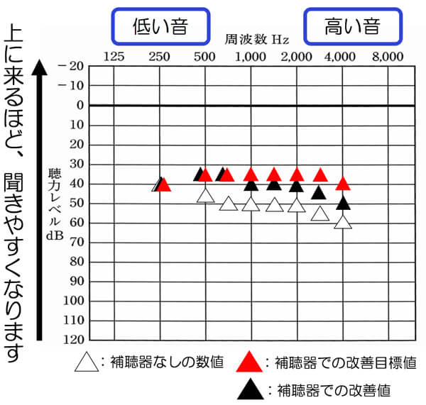 いきなりそこまで改善する。ではなく、少しずつでも大丈夫ですので、その部分まで改善させ、なるべく音を入れられると、その分、聞きにくさも改善しやすくなります。ただし、無理だけは、しないようにすることが大切です。