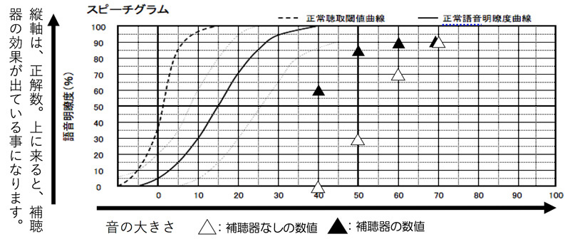 補聴器をつけた状態での言葉の聞こえの測定。概ね、良いところまで改善できています。補聴器なしでの最良値(この場合は、90%)が、補聴器ありでの70dB、60dB、50dBで-10%以内の数値(この場合は80%以上)なら、概ね、良い状態になります。