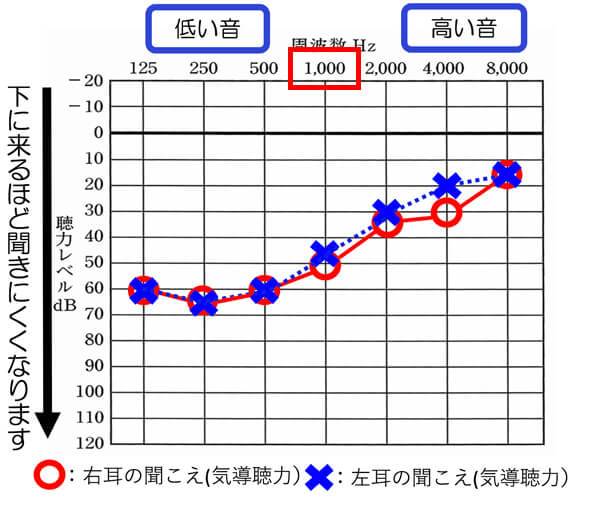 低い音を中心に聞こえにくい耳は、1000Hzが40dBより下の場合は、全体的に音声が聞きにくくなりやすく、1000hzが30dBくらいですと、男性の声を中心として、聞きにくい傾向があります。