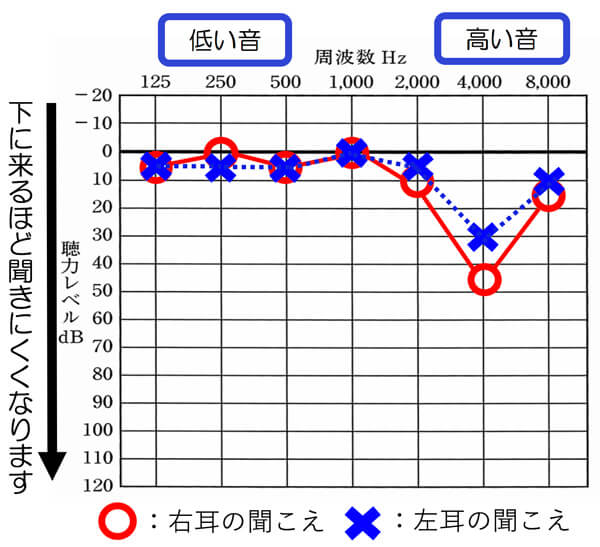 騒音性難聴を理解する6つの基本と4つの聴力別 補聴器での改善方法 パートナーズ補聴器