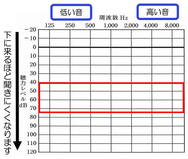 テレアンプⅢの対象となる聴力、補える聴力は、大体、70〜80dBくらいまでになります。これよりも、難聴のレベルが高い場合は、聞きづらくなる傾向が出ます。
