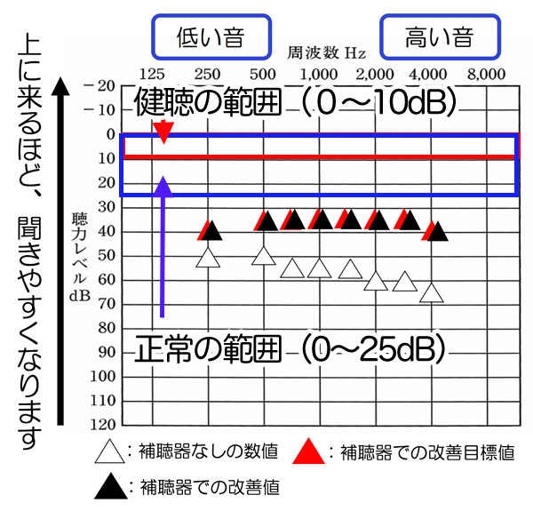 こちらは、補聴器の効果を可視化できるもので表現してみたものです。聴力によって、変化しますが、今現在の補聴器は、概ね、このくらいまで、改善できるようになってきています。