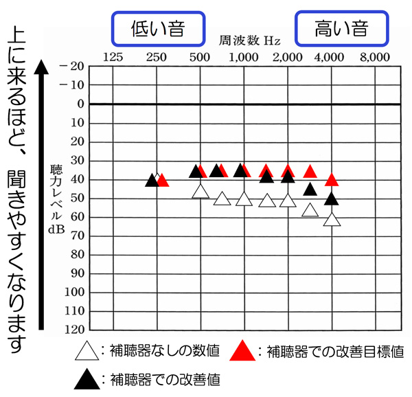 改善目標値と今現在、どこまで聞こえが改善できているのか。その比較をする事で、どこが改善されていて、あと、どこを改善すれば良いのか。その点がわかりやすくなり、聞こえの改善がしやすくなります。