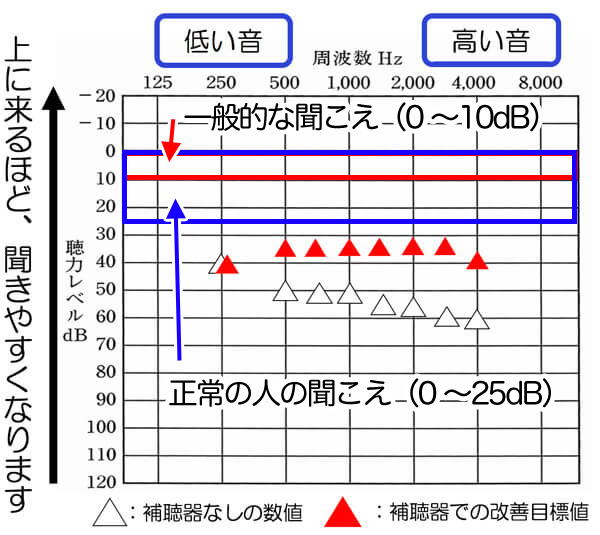 先ほどの聴力の改善例。正常の人の聞こえのラインまでは、改善できないのですが、そこに近いくらいまで改善できると、聞きにくさの改善は、しやすくなります。