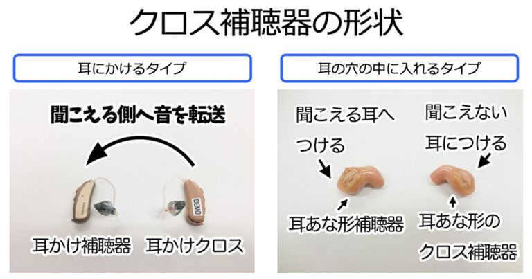 片耳のみ難聴を補聴器で改善する【後編】〜クロス補聴器ver〜パートナーズ補聴器