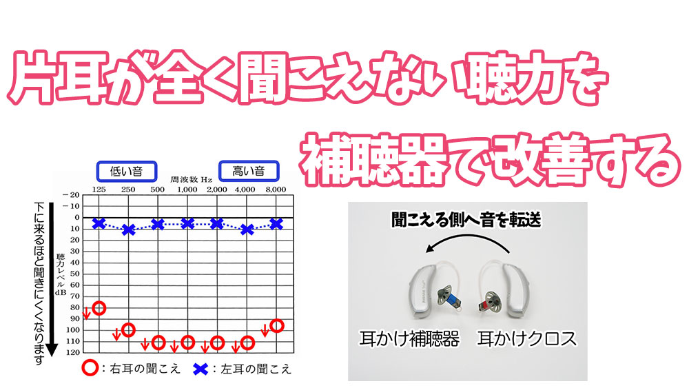 片耳のみ全く聞こえない聴力を補聴器で改善するパートナーズ補聴器