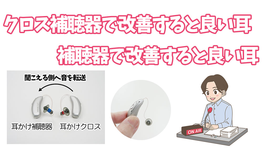 クロス補聴器で改善すると良い耳、補聴器で改善すると良い耳